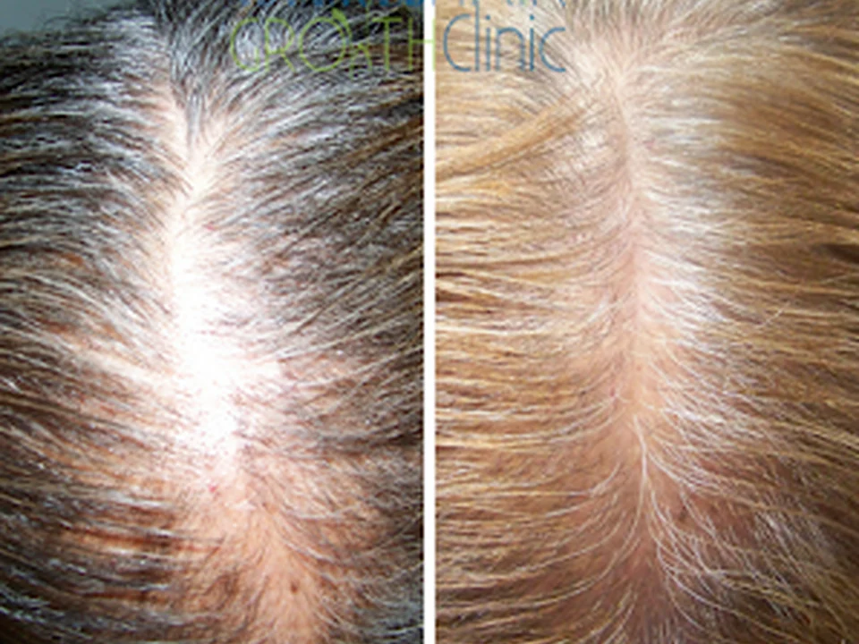 Advanced Hair Growth Clinic