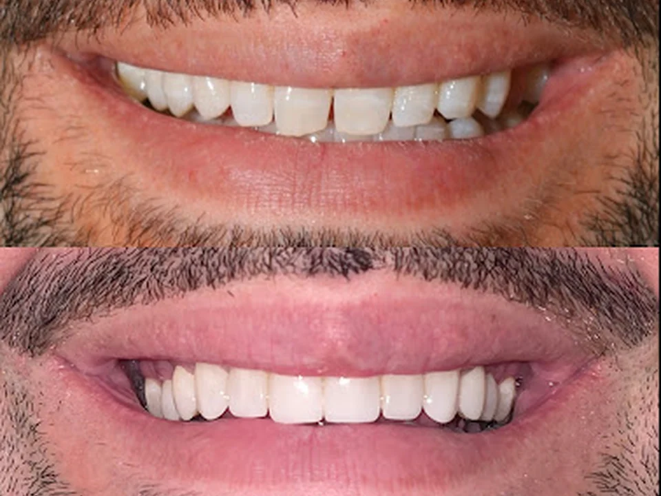 Cosmetic Dentistry of the Carolinas