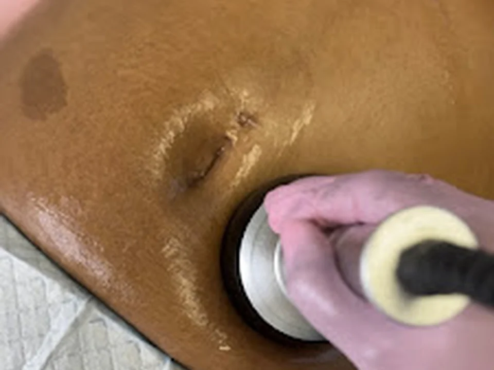 Finesse Beauty & Body Contouring