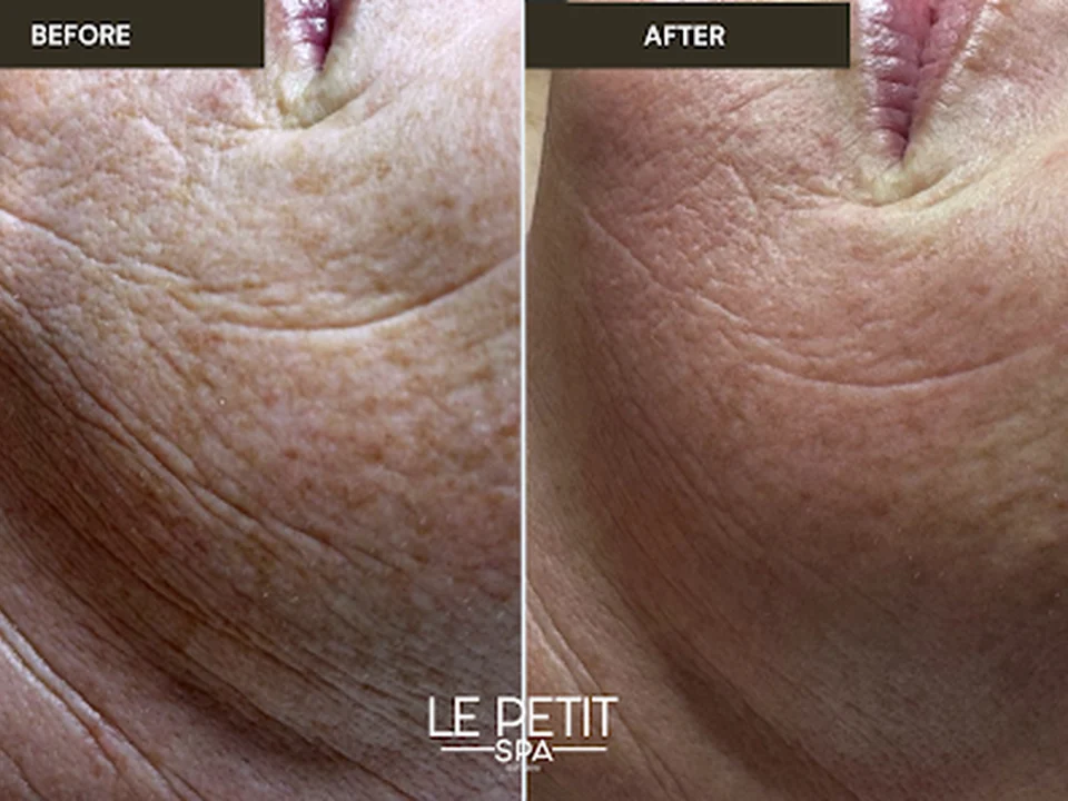Le Petit Spa Ballantyne