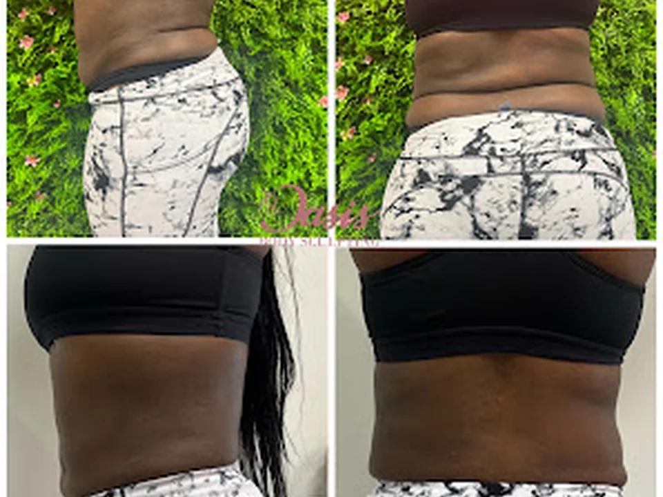 Oasis Body Sculpting