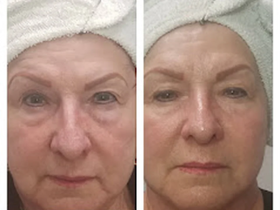 Skin Solutions and More