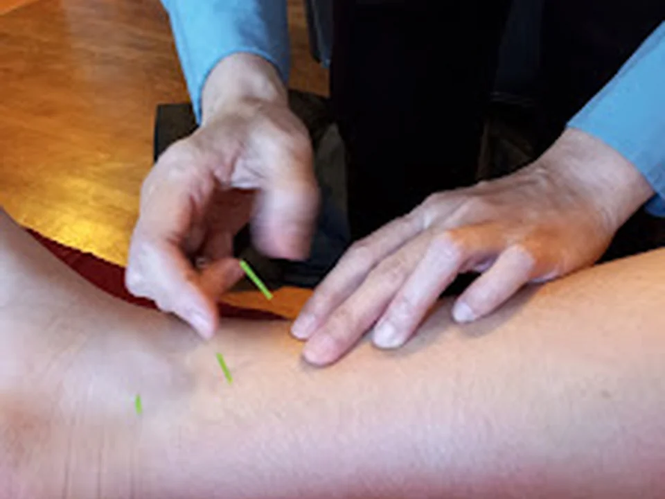 Yun Ann's Acupuncture